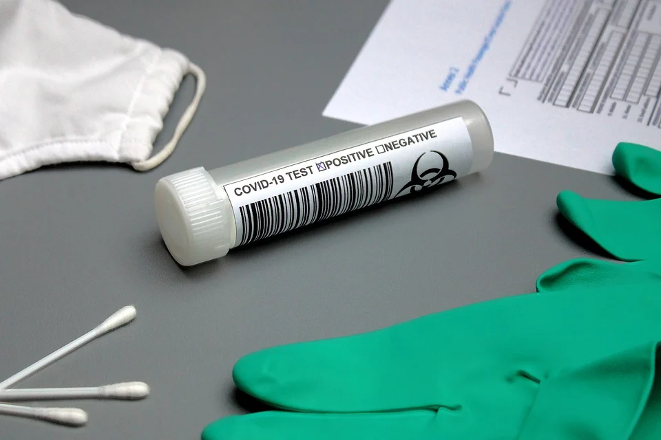 Les tests rapides disponibles dans certaines pharmacies vaudoises
