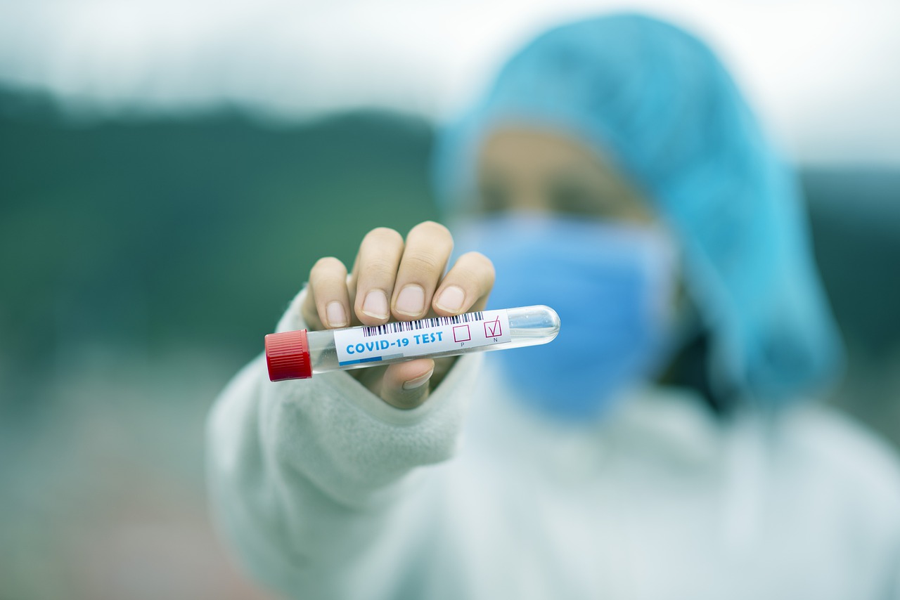 Covid-19: Hausse des tests en vue dans les cantons de Vaud et du Valais