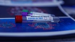 Test COVID à Beaulieu Lausanne: données à compléter pour certaines personnes testées entre le 6 et le 25 juillet